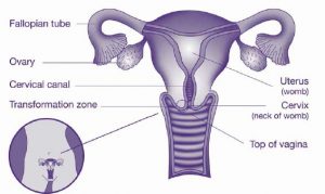 pap smear, gyneacology Newcastle